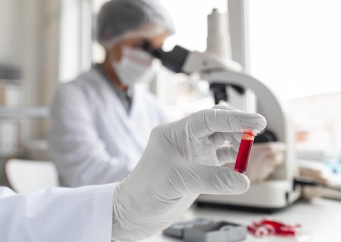 AVC infarctus maladies cardiovasculaires découverte prise en charge Ma Santé Des chercheurs qui étudient les maladies cardiovasculaires.