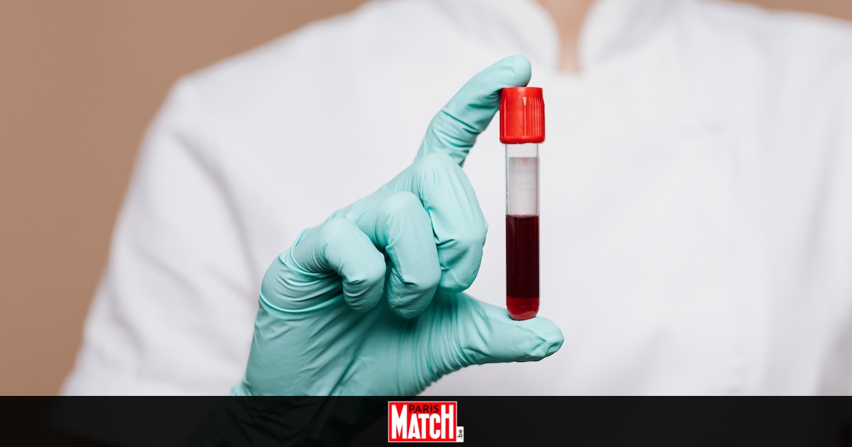 Si vous dépassez ce taux de cholestérol dans le sang, vous risquez de faire un AVC