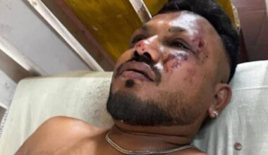 Viswash Kumar Ramesh, le miraculé du crash d’Air India – Libération