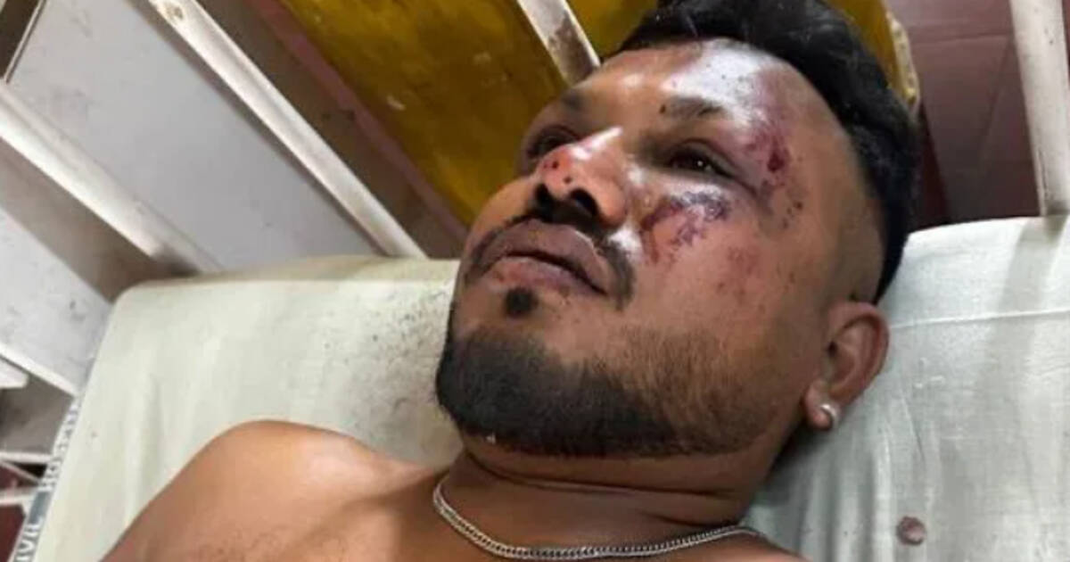 Viswash Kumar Ramesh, le miraculé du crash d’Air India – Libération