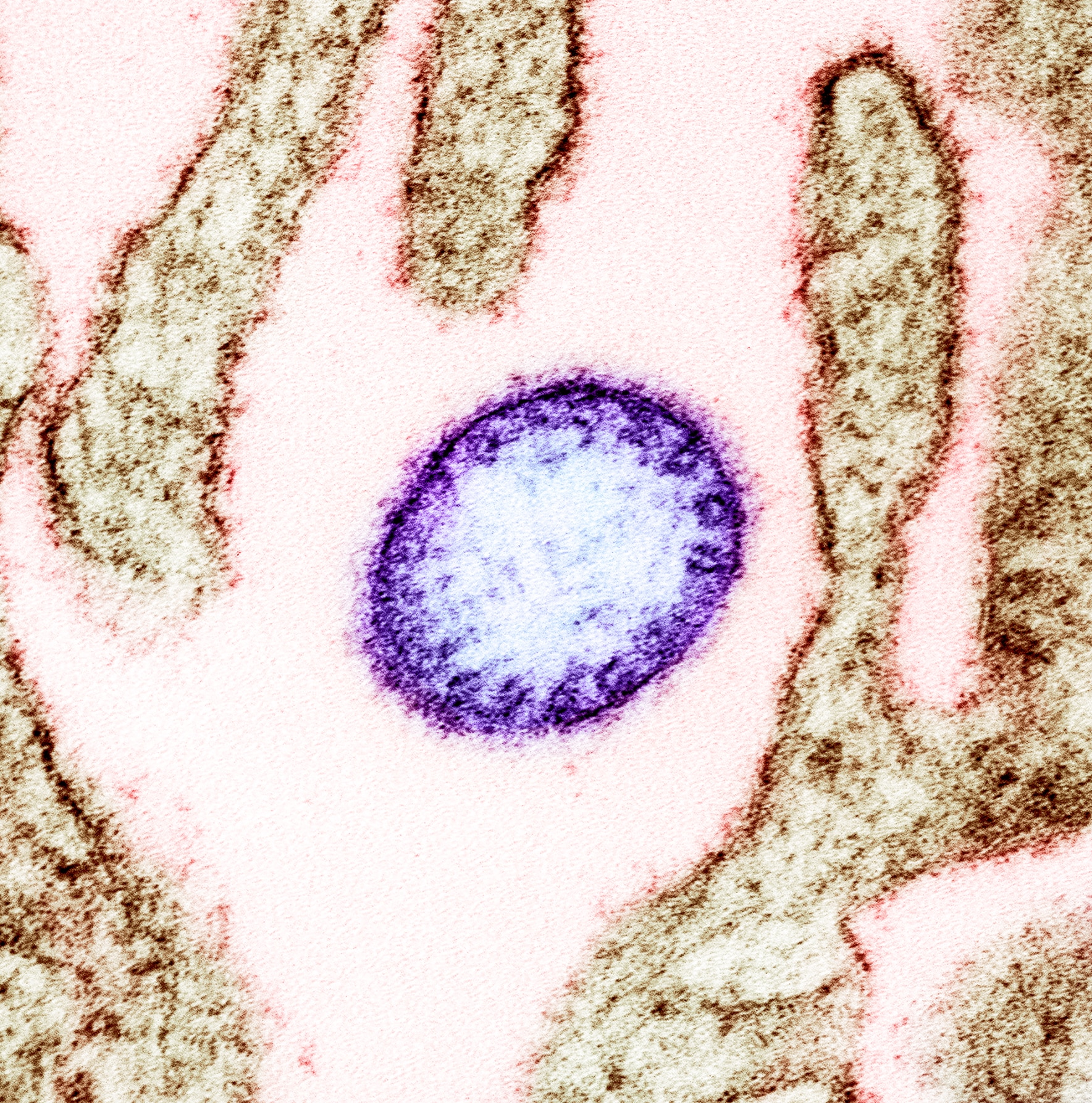 chauve-souris virus