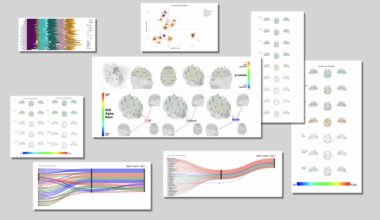 ChatGPT est-il en train de casser le cerveau humain ? 5 points sur l’alarmante étude du MIT sur les effets de l’IA