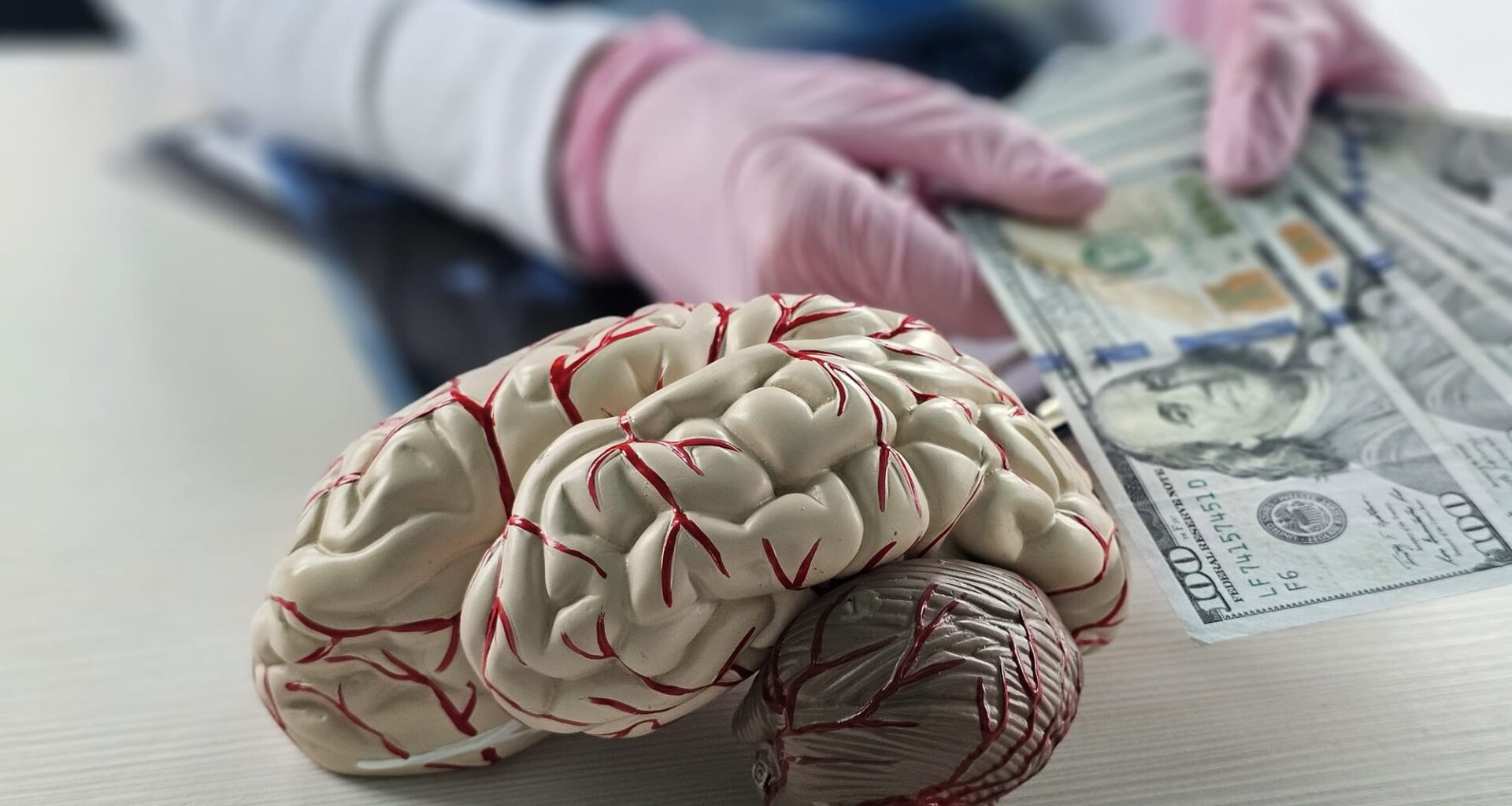 Alzheimer