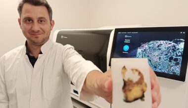 un laboratoire bordelais analyse des cas de guérisons exceptionnelles
