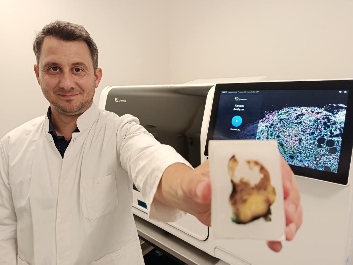 un laboratoire bordelais analyse des cas de guérisons exceptionnelles