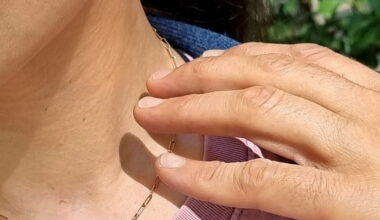 encore des agressions, l’inquiétude monte à Lyon