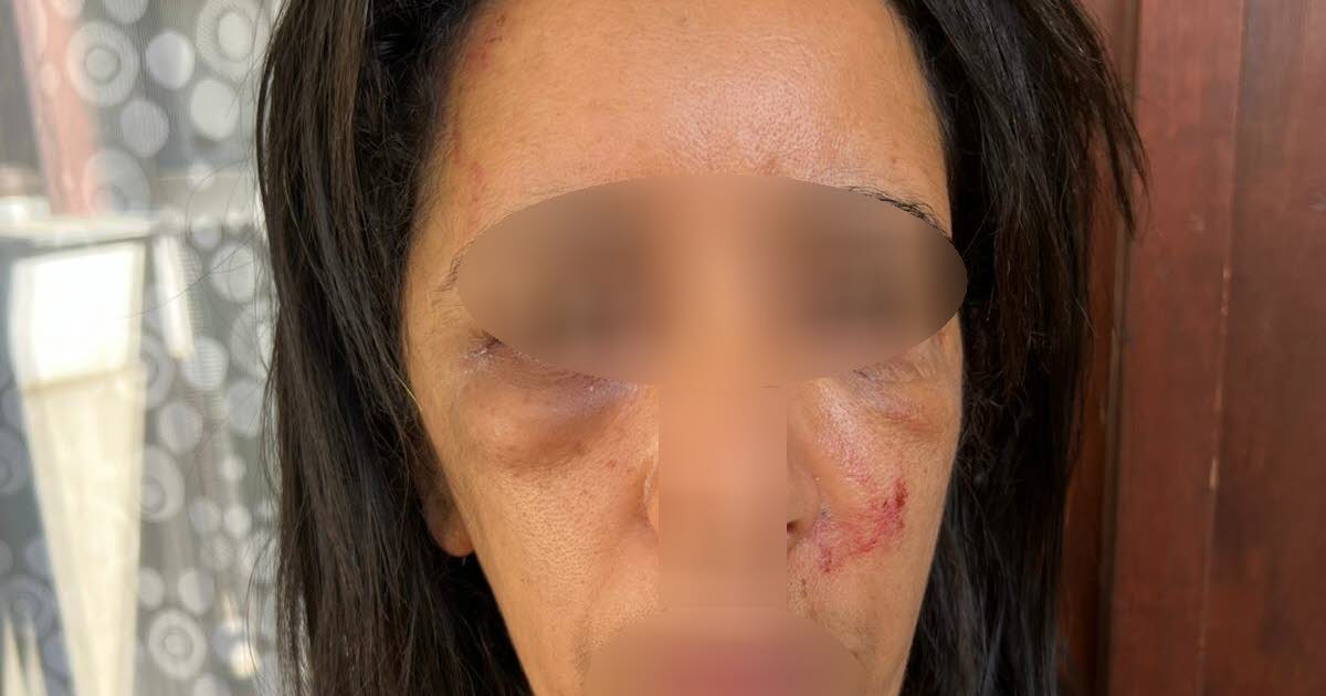 Grenoble. « Parce que mon frère leur doit de l’argent, des dealers persécutent notre famille » : menaces, agressions, appartements incendiés...