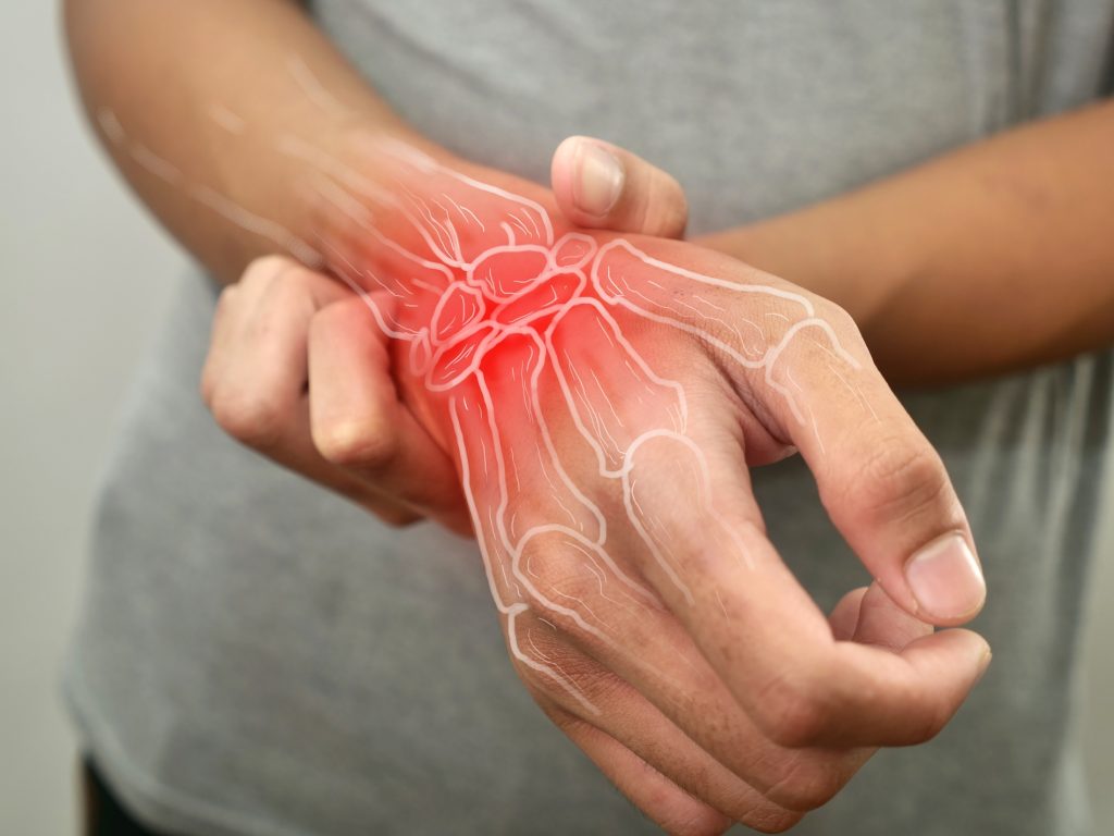 Polyarthrite rhumatoïde : "Si vous avez ces 3 symptômes, rendez-vous à l'hôpital d'urgence", alertent deux rhumatologues