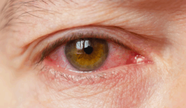 Une nouvelle routine validée par la science pour lutter contre la sécheresse oculaire