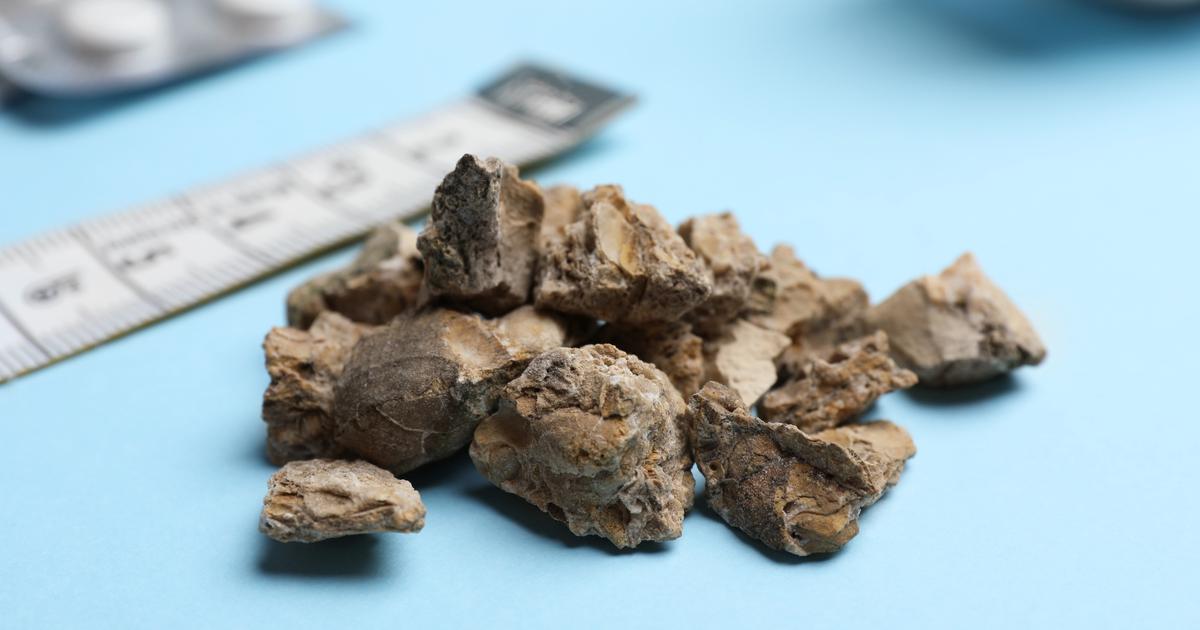 les promesses d’une bactérie mangeuse de calcium implantée dans l’intestin