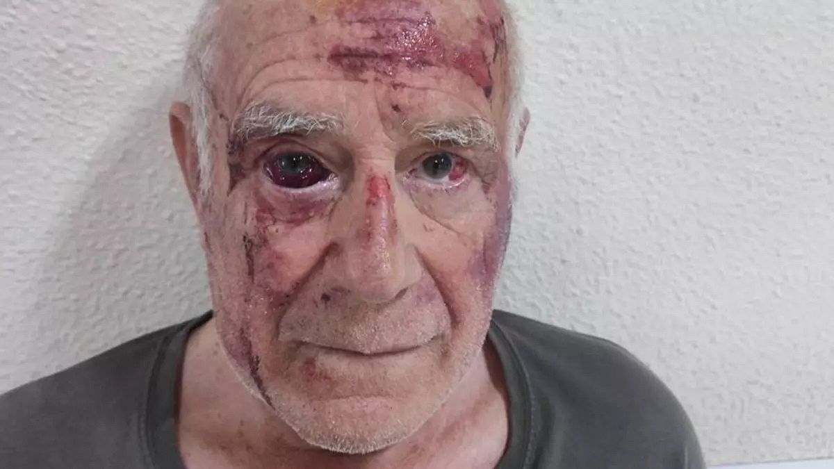 Espagne : une attaque filmée d’un vieil homme alimente les tensions à Torre Pacheco