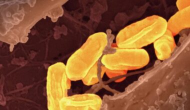 Quelle est cette bactérie qui pourrait faire exploser le nombre de cas de cancers de l’estomac à l’avenir ? : Actualités