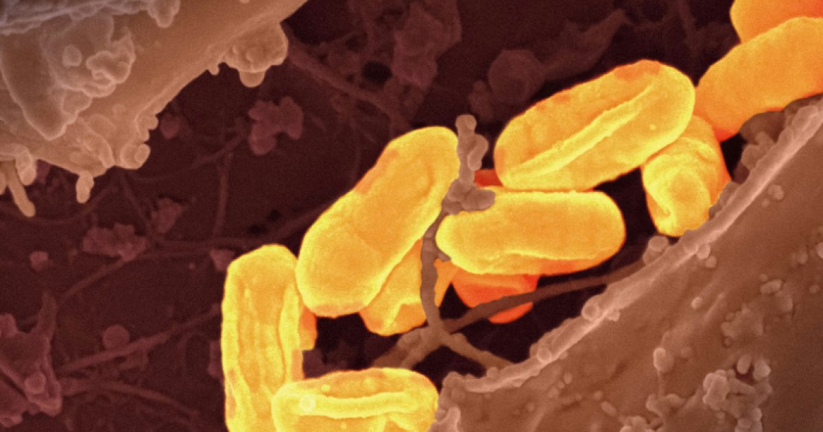 Quelle est cette bactérie qui pourrait faire exploser le nombre de cas de cancers de l’estomac à l’avenir ? : Actualités