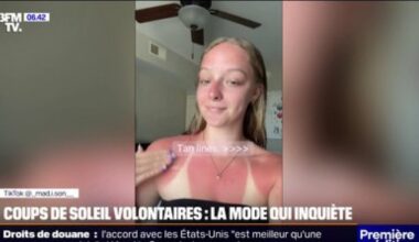La tendance des "burn lines" inquiète les dermatologues - Actualités – Orange