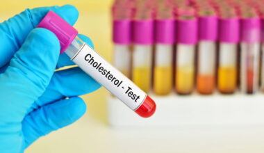 Voici le taux de cholestérol à ne jamais dépasser après 70 ans, selon un chirurgien cardiaque