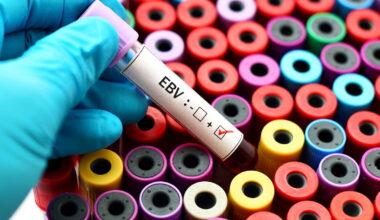 Ce virus courant est bien plus dangereux qu'on ne le pensait, il multiplie par 5 le risque d'avoir un cancer