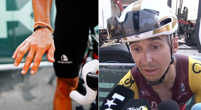 TDF. Tour de France - Bryan Coquard sera au départ de la 13e étape avec une attelle