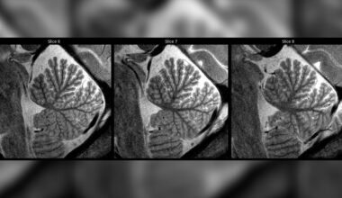 « Ces images sont pleines de promesses » : le cerveau des enfants dévoilé par une IRM surpuissante