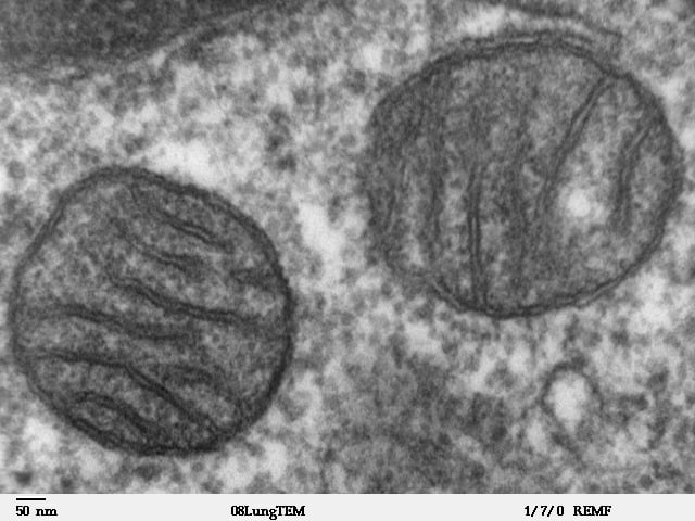 Mitochondria, Mammalian Lung Tem
