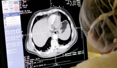 Cancer du foie : le nombre de cas pourrait doubler d’ici 2050, alors que la plupart sont évitables