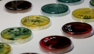 « Helicobacter pylori » : c’est quoi cette bactérie qui pourrait causer des millions de cancers de l’estomac dans les décennies à venir ?