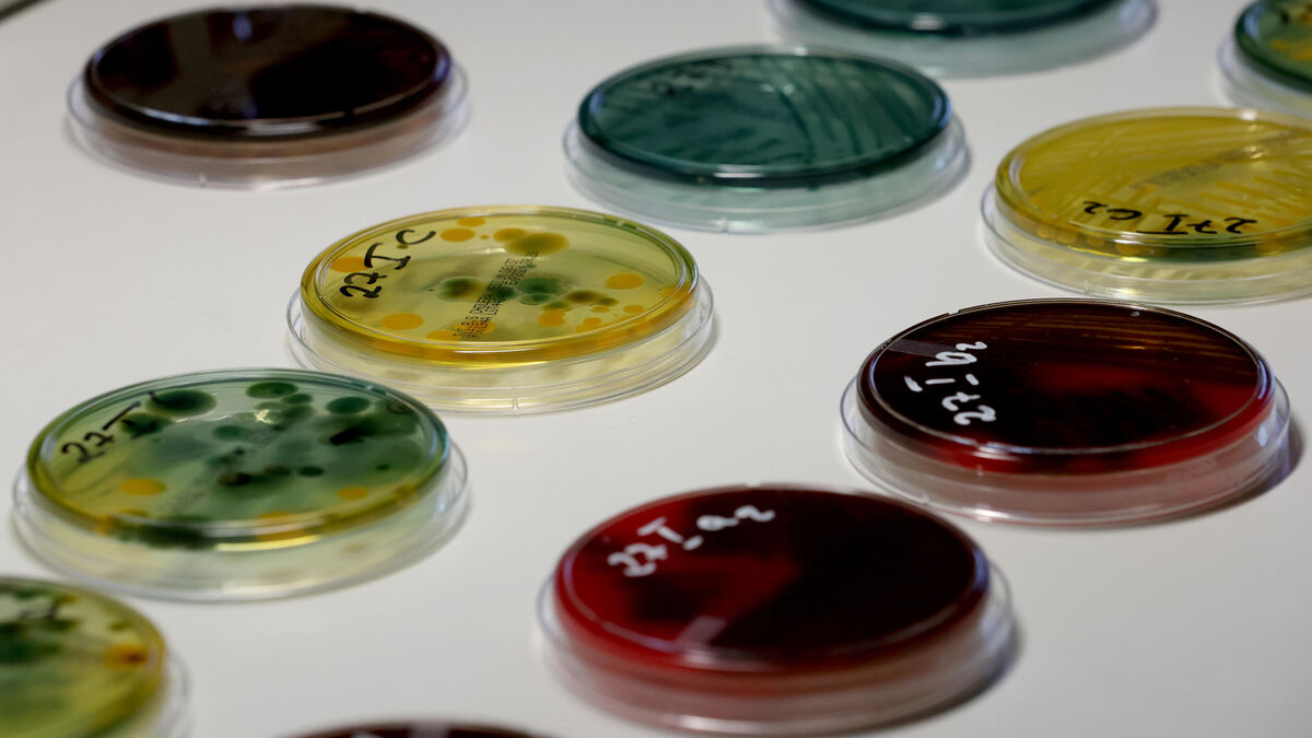 « Helicobacter pylori » : c’est quoi cette bactérie qui pourrait causer des millions de cancers de l’estomac dans les décennies à venir ?