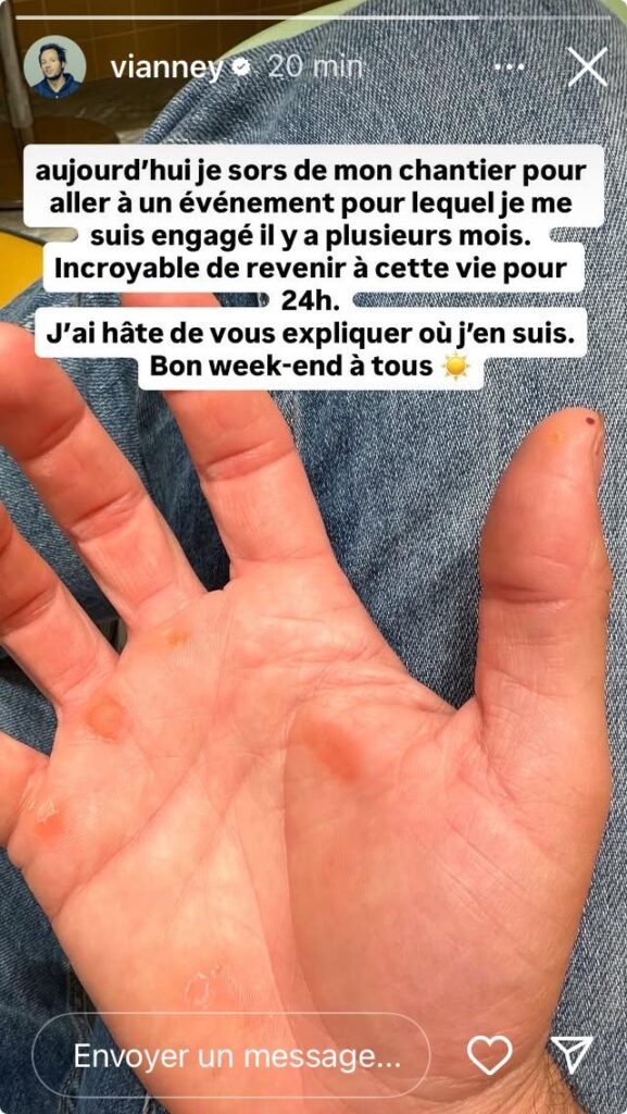 Vianney : sa nouvelle vie de charpentier n'est pas sans danger