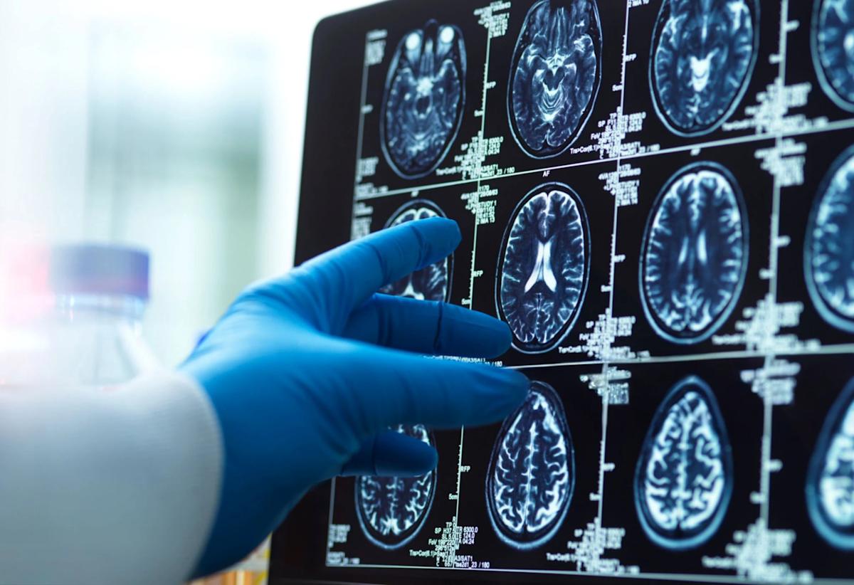 Il pense que sa femme lui est infidèle, c'était en réalité le signe d'un cancer mortel