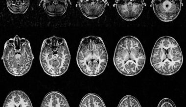 une nouvelle technique d’IRM permet d’obtenir des images d’une précision inédite