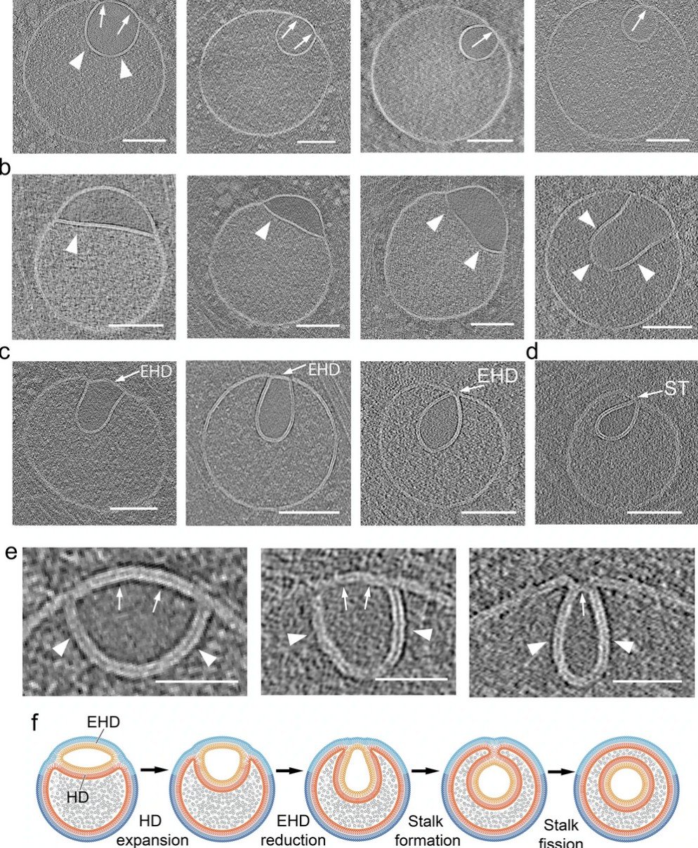 Hemifusomes Vesicules