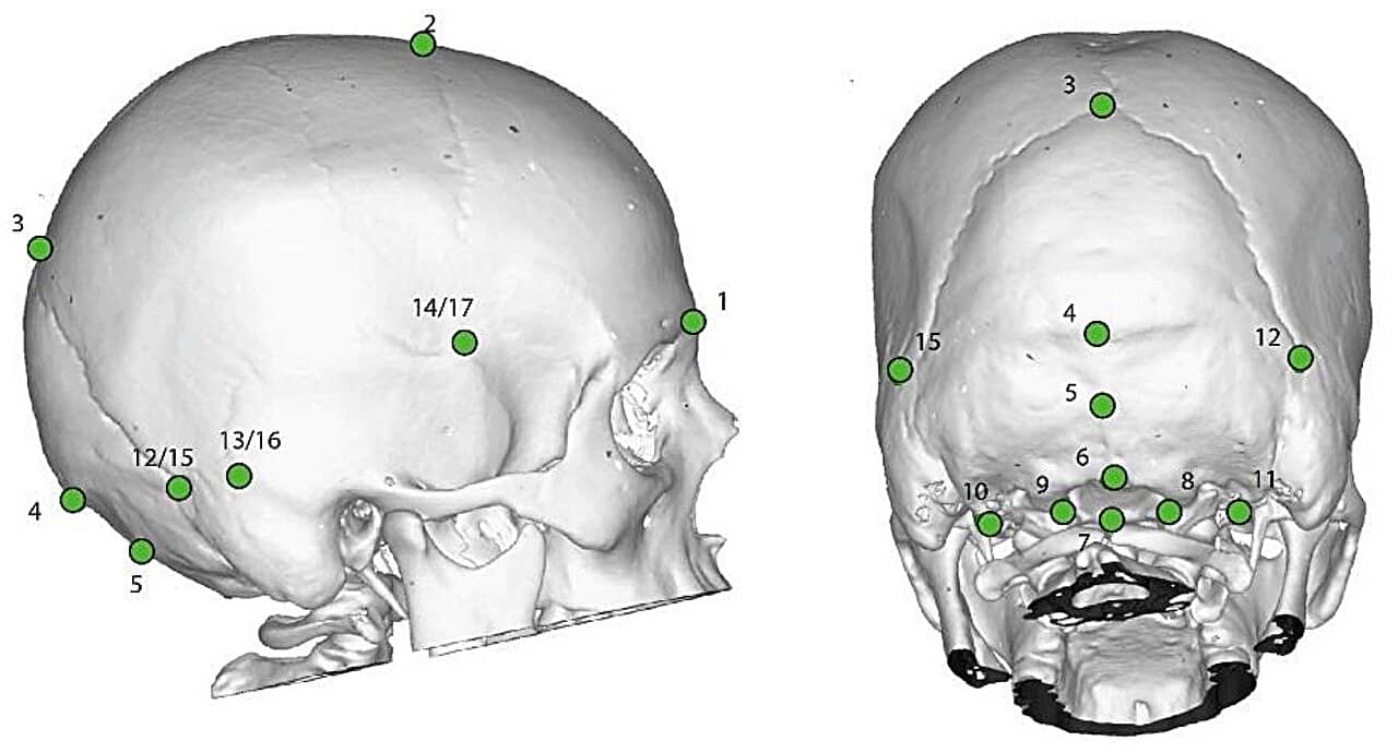 troubles neurologique néandertaliens néandertal