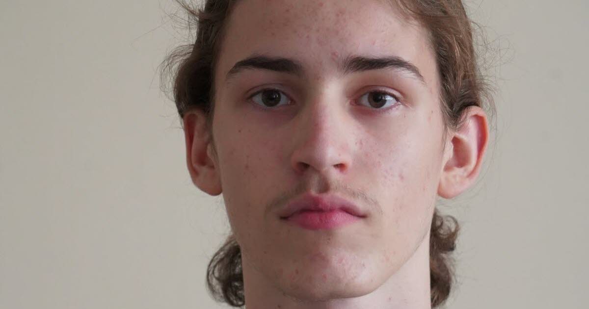 Nancy, lycée Henri-Loritz | Bac 2025 Mention Très Bien. Baptiste Champagnat, 17 ans, bac général