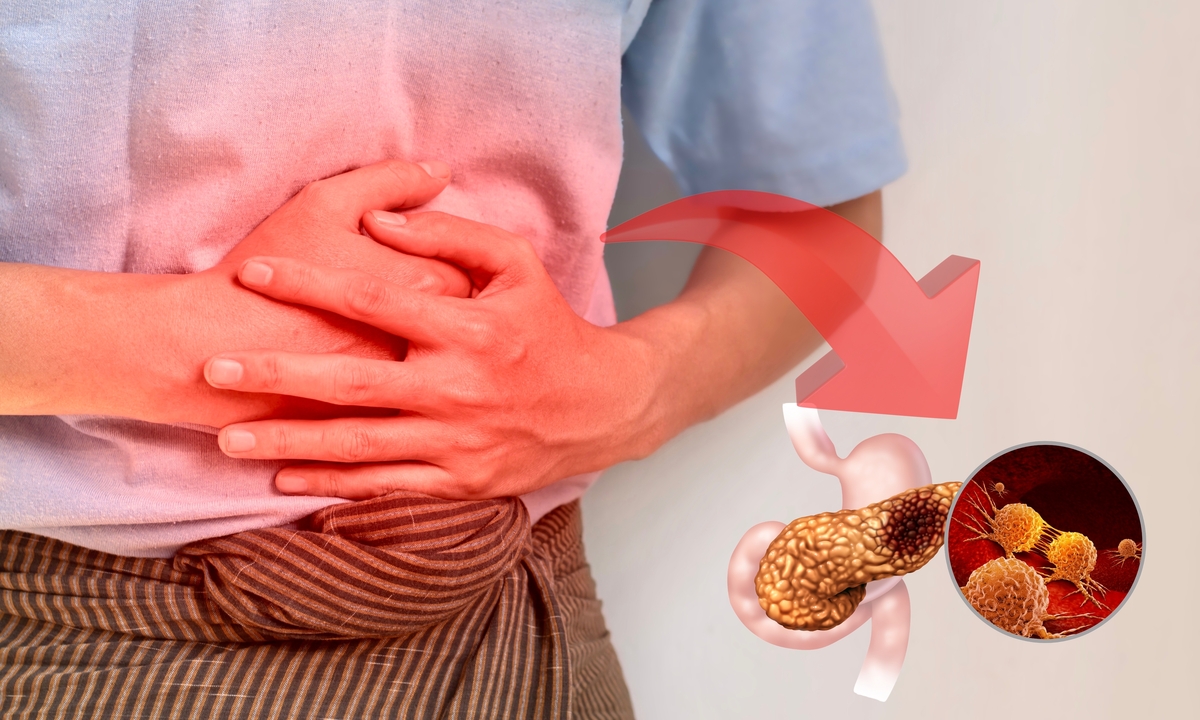 voici le type de profil le plus exposé selon l’Institut national du cancer