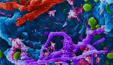 Qu’est-ce que le « syndrome d’auto-brasserie » ou comment notre microbiote peut-il se transformer en microbrasserie ?