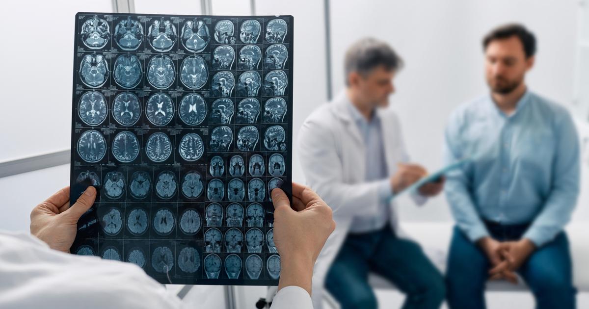 Accidents, maladies... Comment le cerveau parvient à se réparer