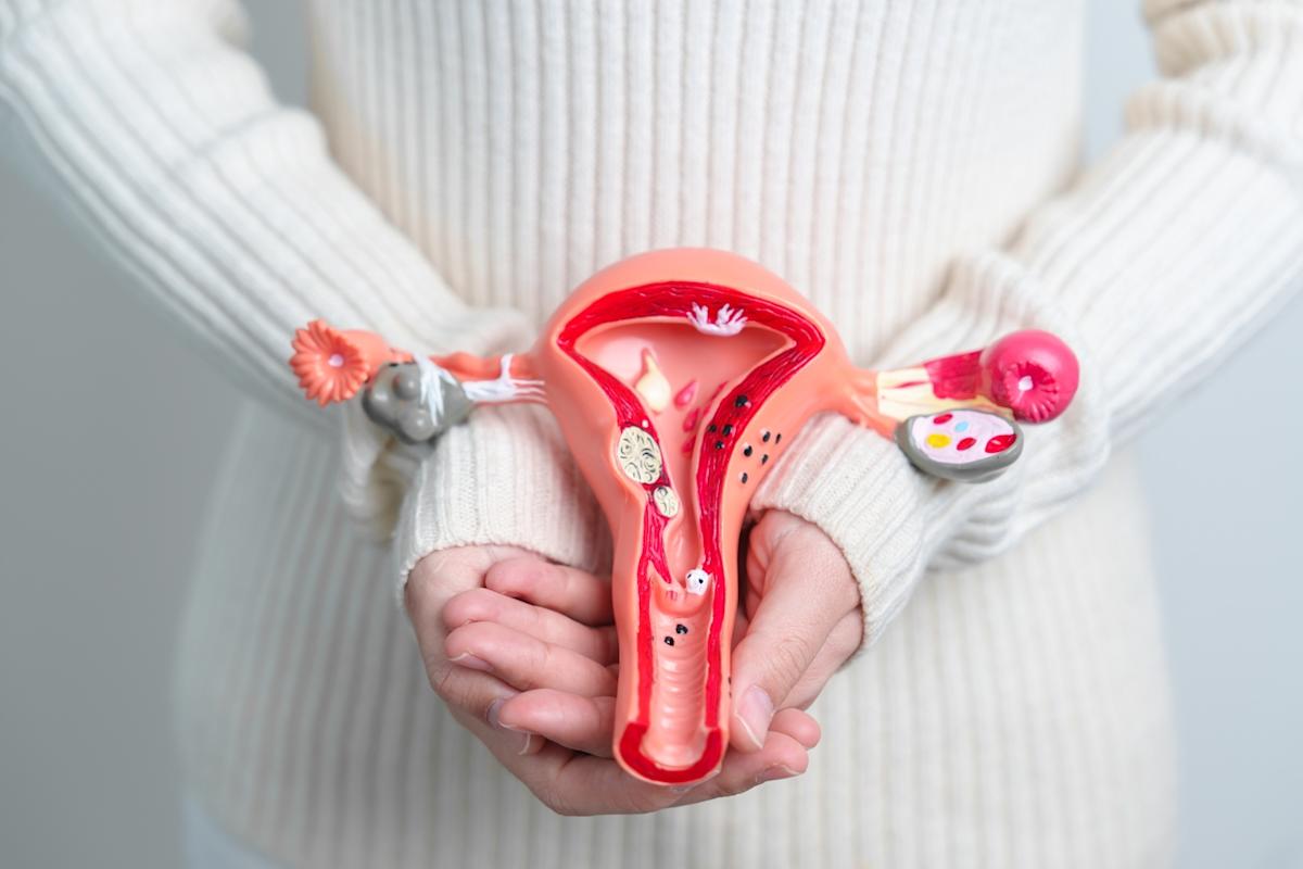 Le cancer de l'ovaire touche 5000 femmes par an en France, voici les 9 neufs symptômes principaux