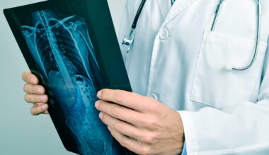 ces aliments pourraient augmenter le risque de cancer du poumon