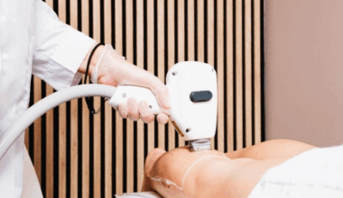 Smart Duck : l’épilation laser haut de gamme sans se faire plumer