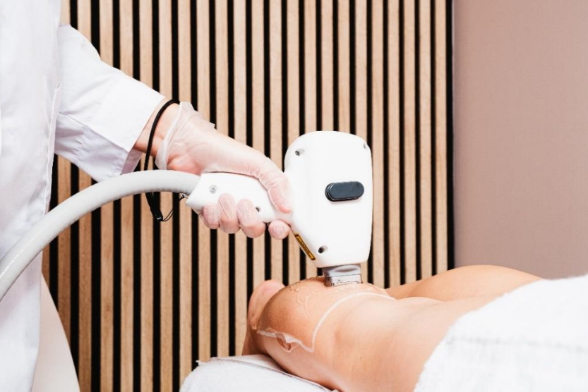 Smart Duck : l’épilation laser haut de gamme sans se faire plumer