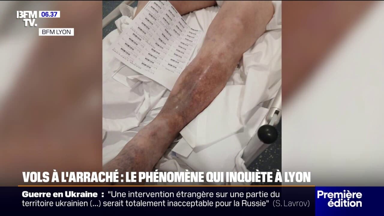 recrudescence des vols à l'arraché