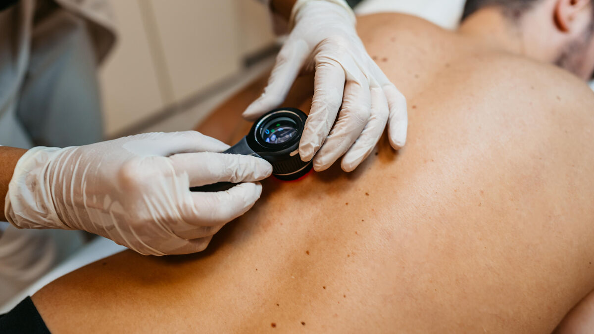 Traitements, vaccins… Les espoirs fous de la recherche contre le cancer de la peau