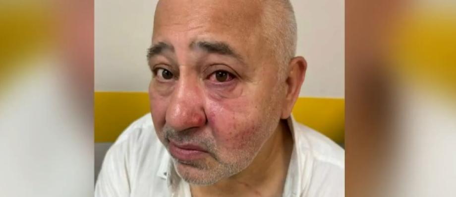 Antisémitisme : Deux hommes juifs victimes d’agressions, en quelques heures, dans des villes d'Île-de-France, a priori car ils portaient une kippa - Témoignage vidéo