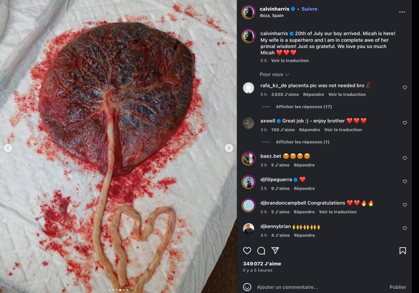 Une star de la télé a accouché à la maison et on ne remercie pas son mari célèbre DJ pour la photo du placenta