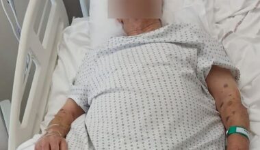 Angelo, 86 ans, passé à tabac pour un bijou