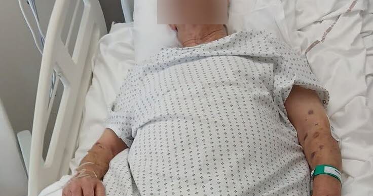 Angelo, 86 ans, passé à tabac pour un bijou