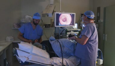 Genève. Une alternative à la coloscopie pour détecter le cancer colorectal