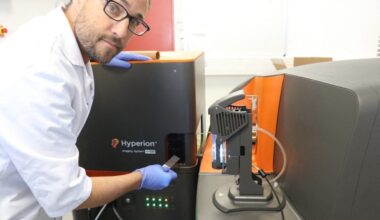 l’ARC soutient un projet de recherche de l’ICM sur le cancer de la peau
