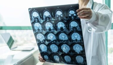 Qu’est-ce qui déclenche la maladie d’Alzheimer ? Une équipe de chercheurs a peut-être trouvé la réponse