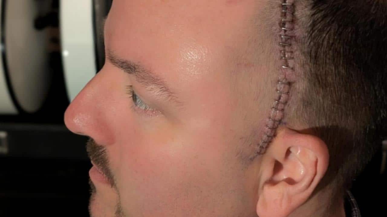 “Je vais un peu mieux chaque jour” : Wayne Lozinak (Hatebreed) donne des nouvelles après son opération