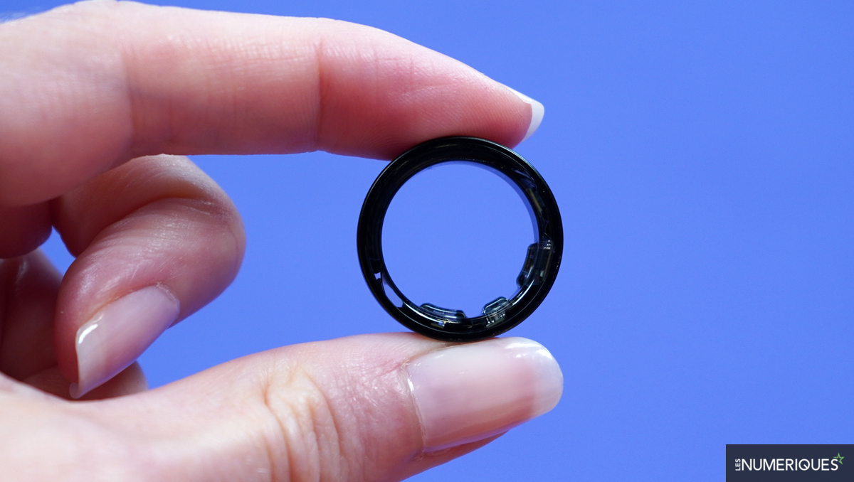 La batterie de son Galaxy Ring gonfle et l'envoie à l'hôpital en urgence, les images font froid dans le dos